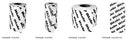 Mueller Pro Strips - Pre-Cut Strips or 2, 4 or 6 in Wide Roll